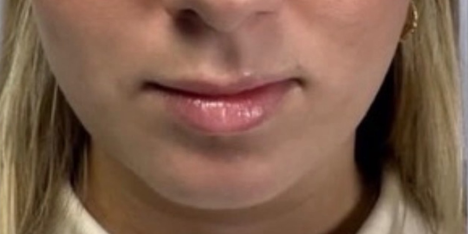 Close-up of a woman's mouth and chin.