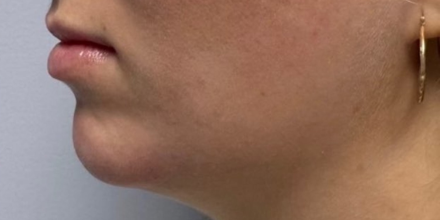 Profile of a person with earrings and smooth skin