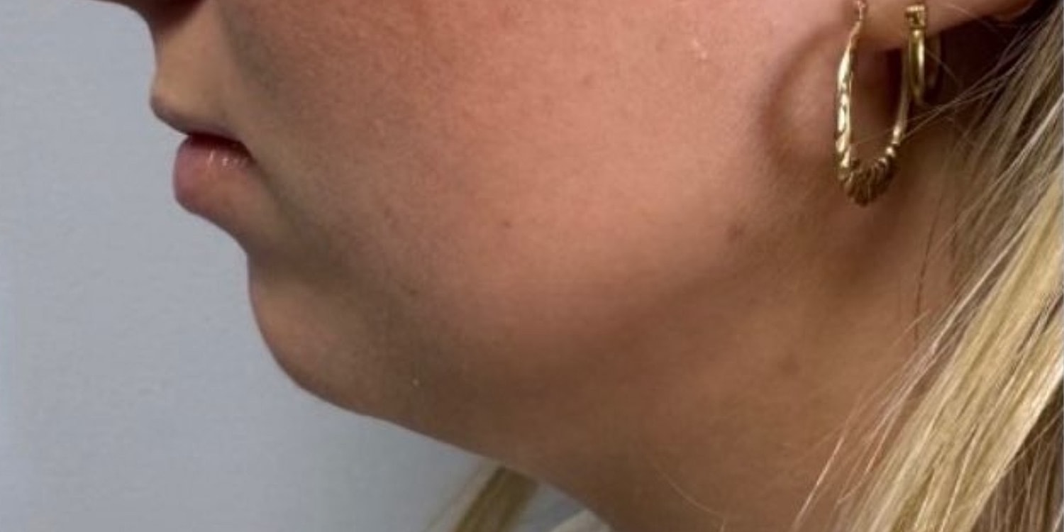 Profile view of woman with large hoop earrings.