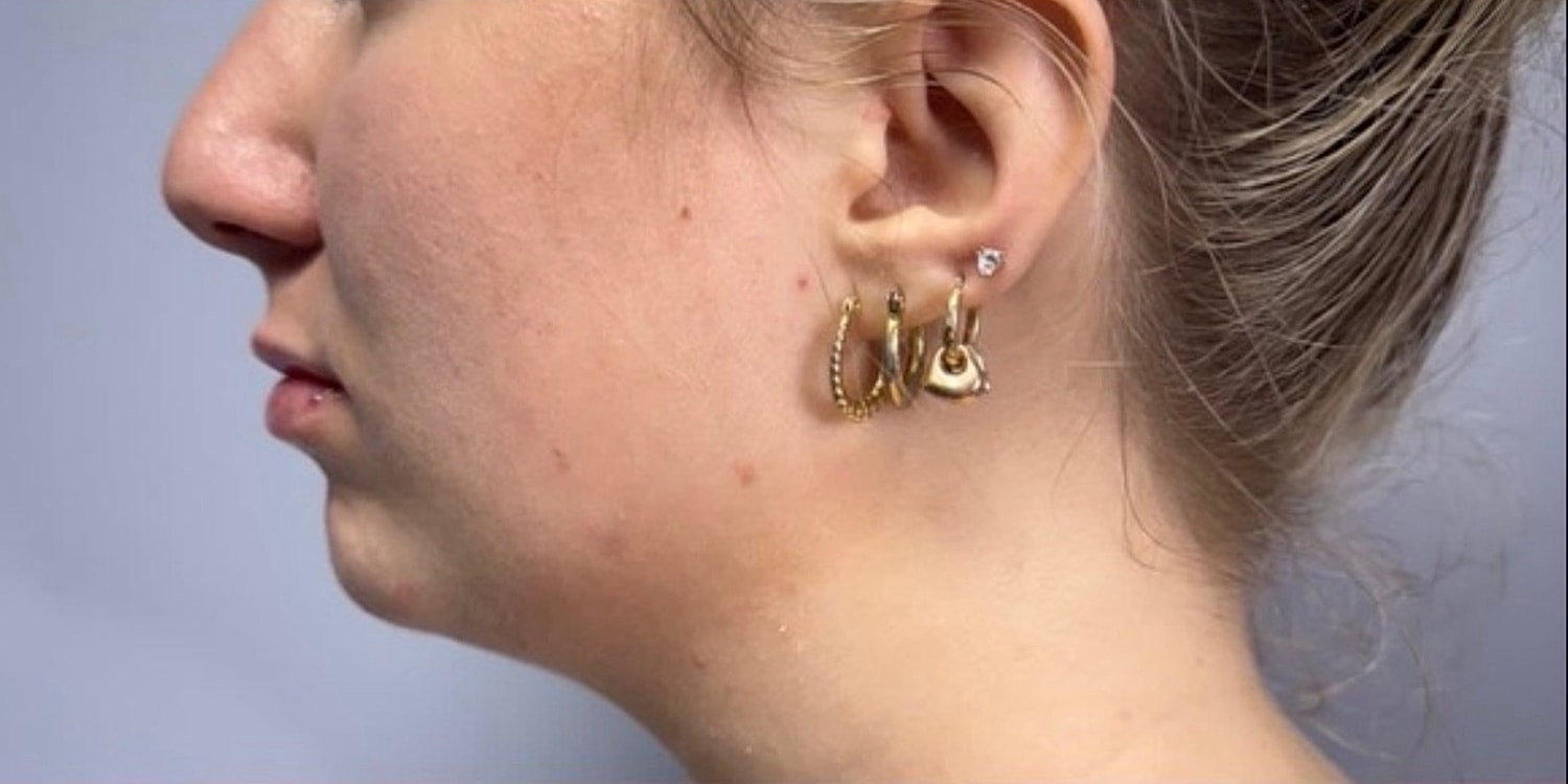 Woman's ear with multiple gold earrings visible.