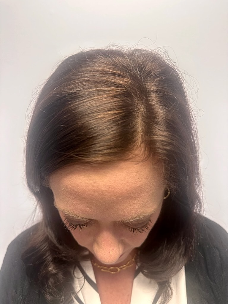 Woman with brown hair looking downwards.