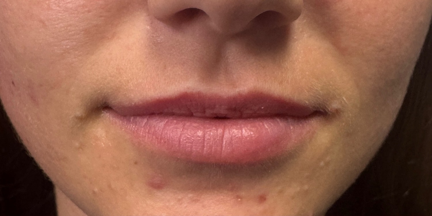 Close-up of lips and skin texture.