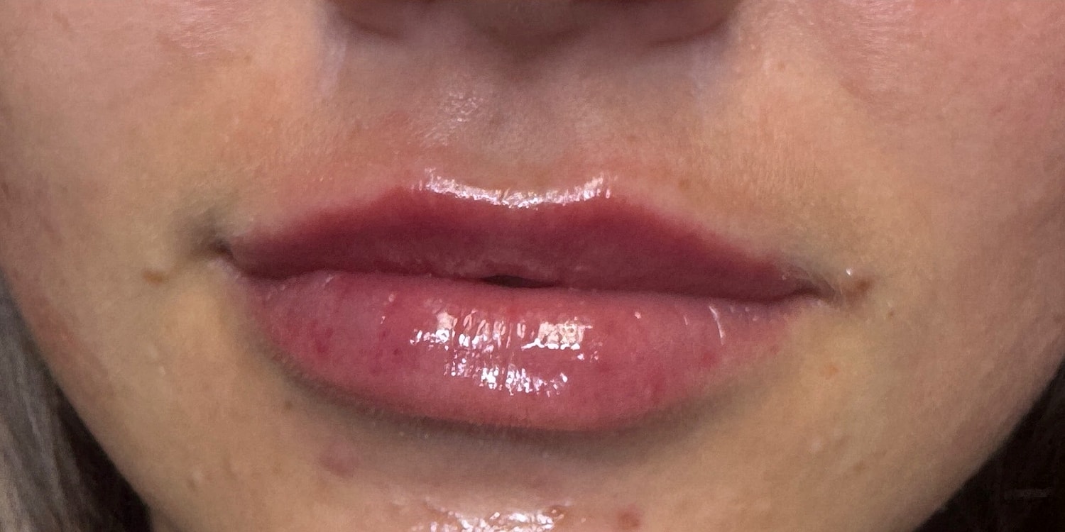 Close-up of glossy, plump lips.