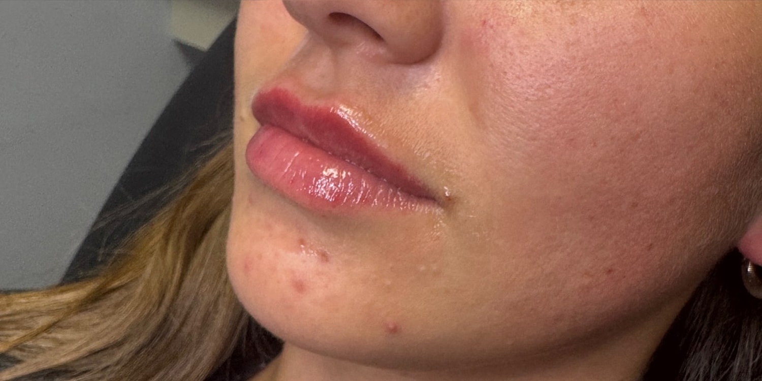 Close-up of a woman's lips and chin.
