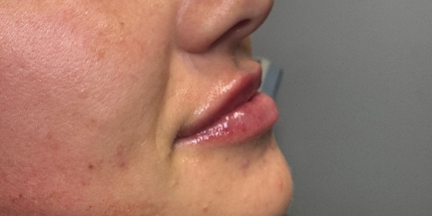 Close-up of a woman's lips and skin.