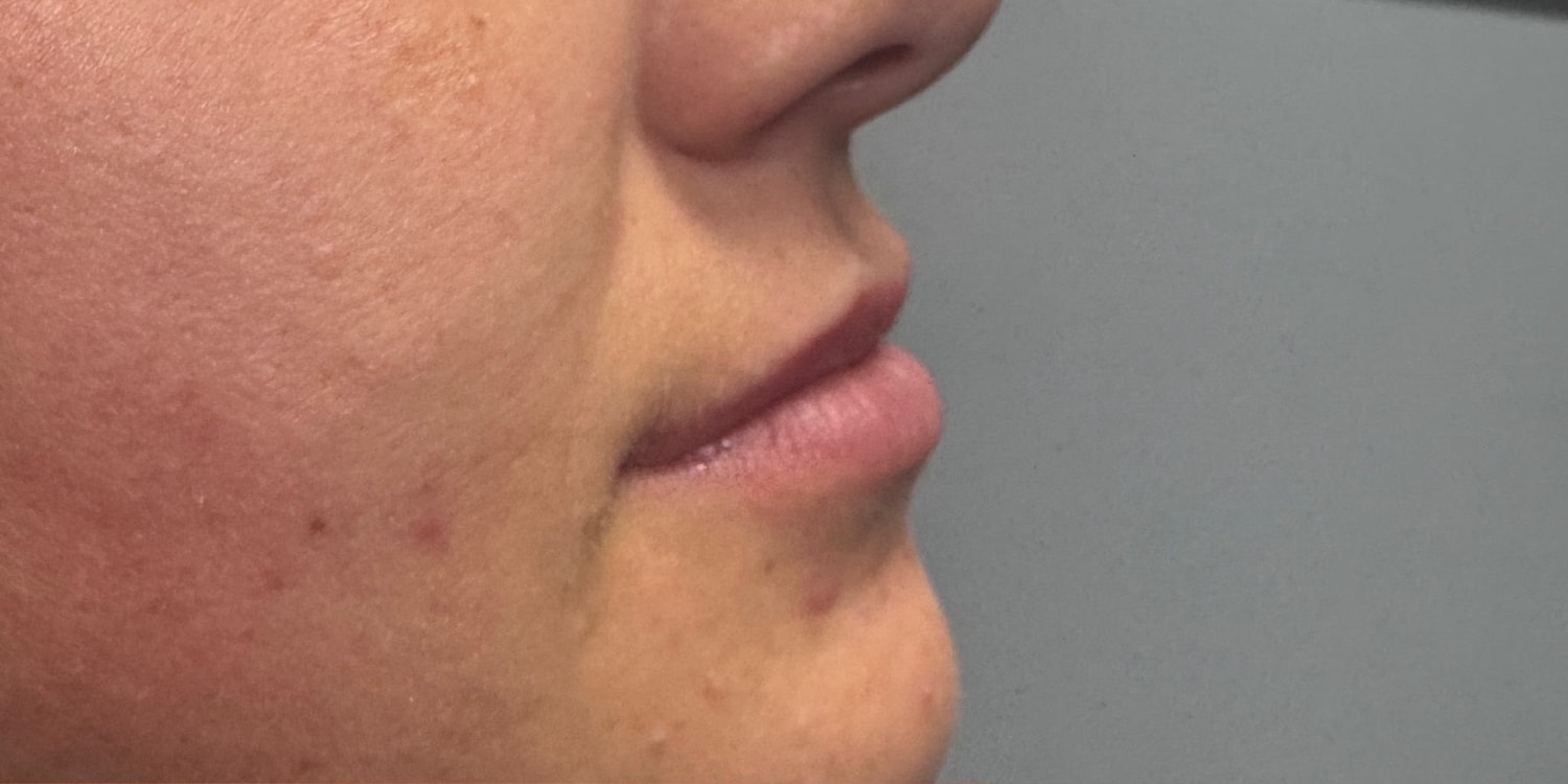 Close-up of a woman's lips and cheek.
