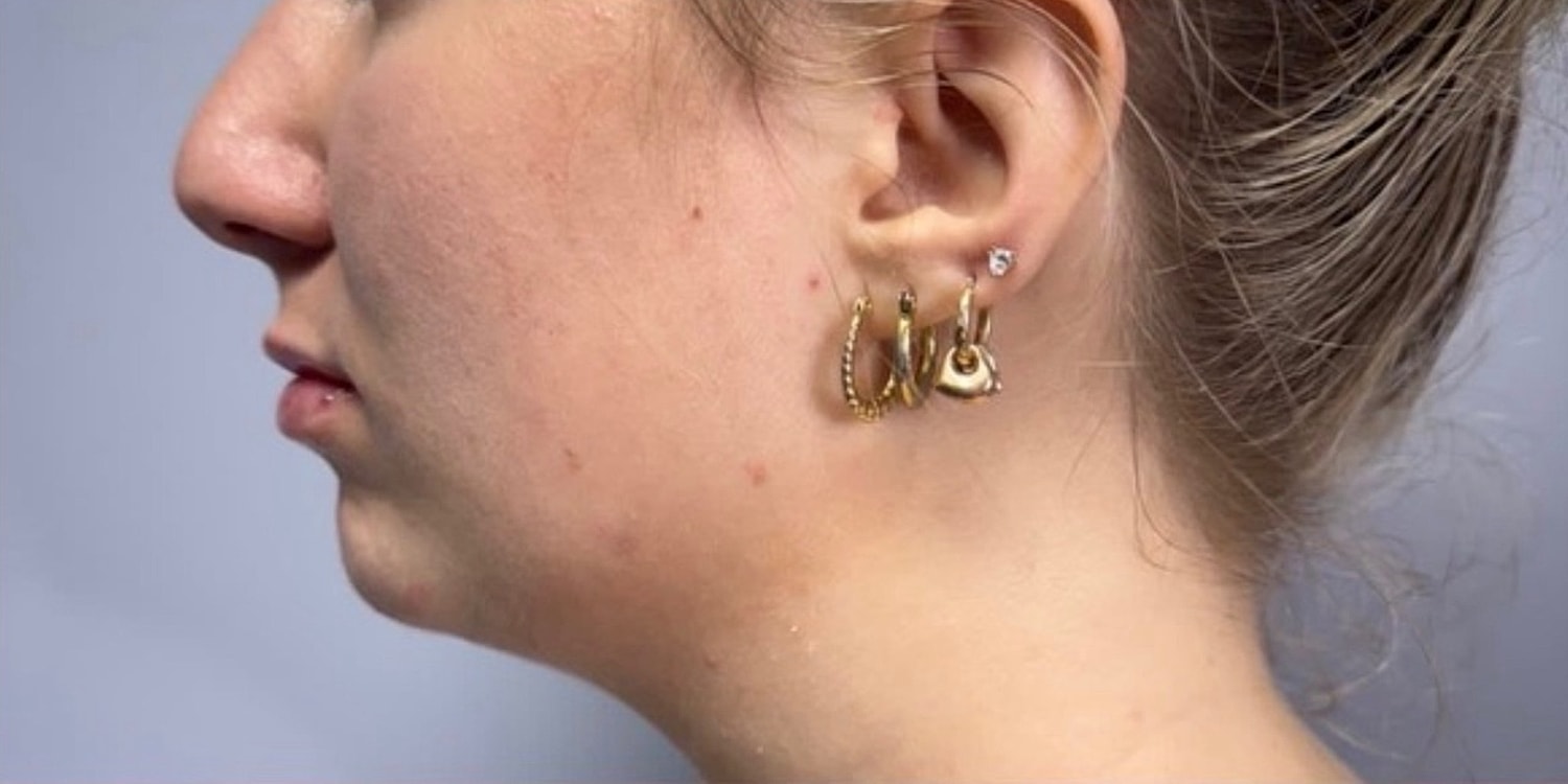 Young woman with multiple gold earrings.