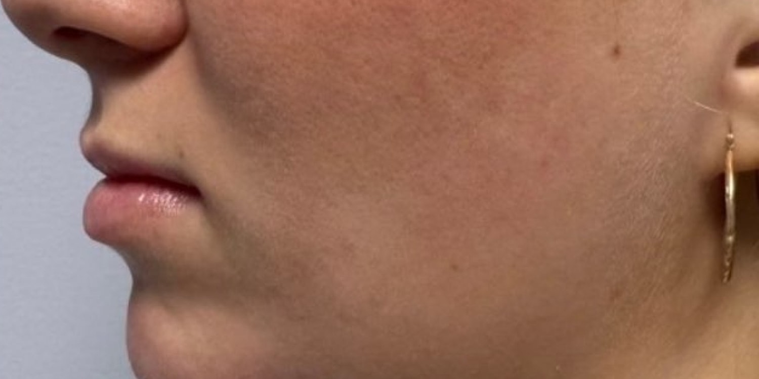 Profile view of a person’s face.