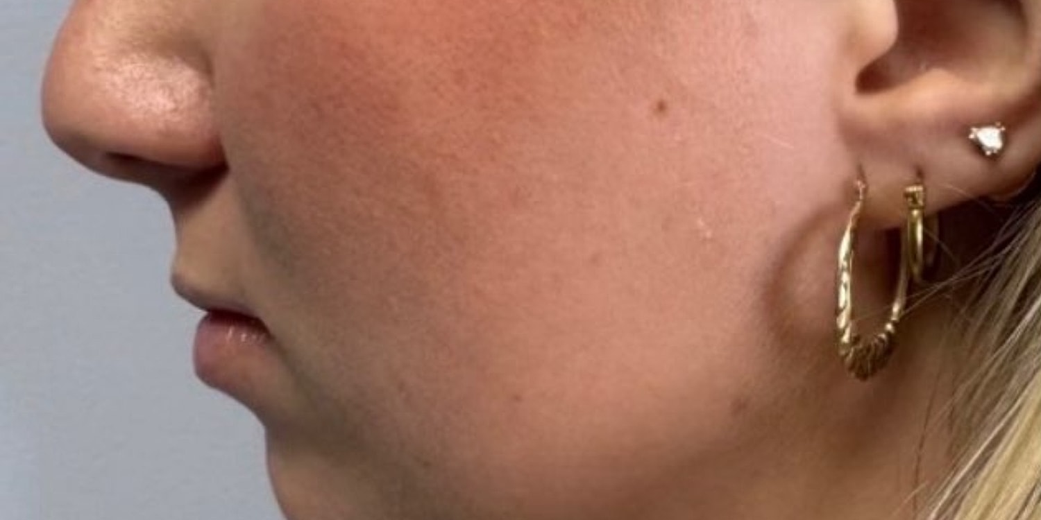 Close-up of a woman's side profile and earrings.