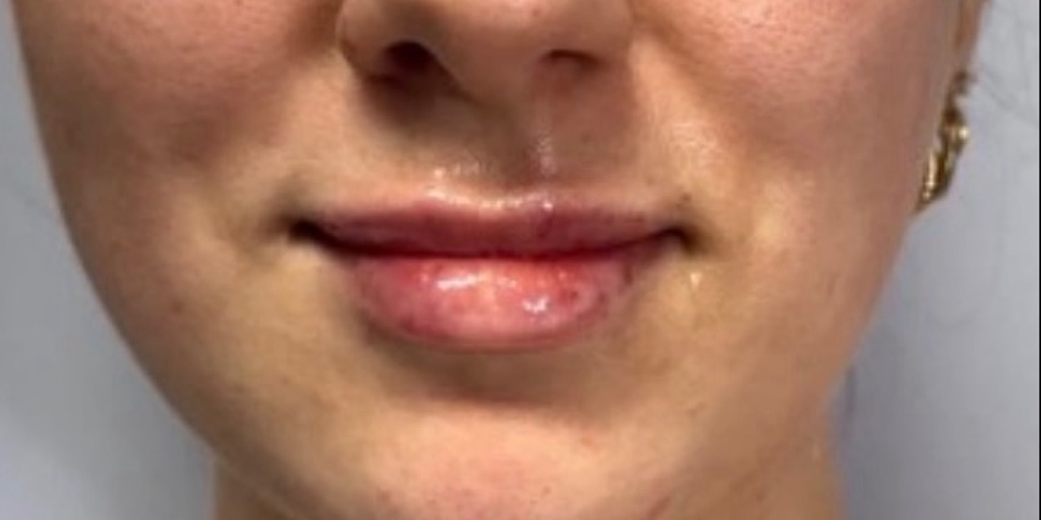 Close-up of woman's lips and chin area.