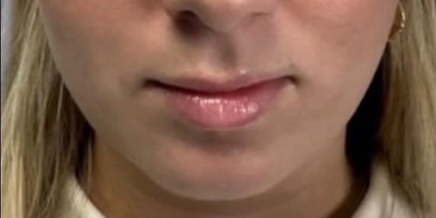 Close-up of lips and chin.